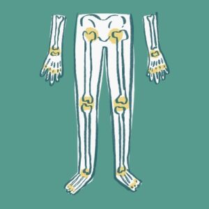 Joint Pains