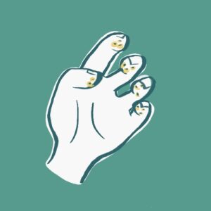 Finger Pitting or Ulcers
